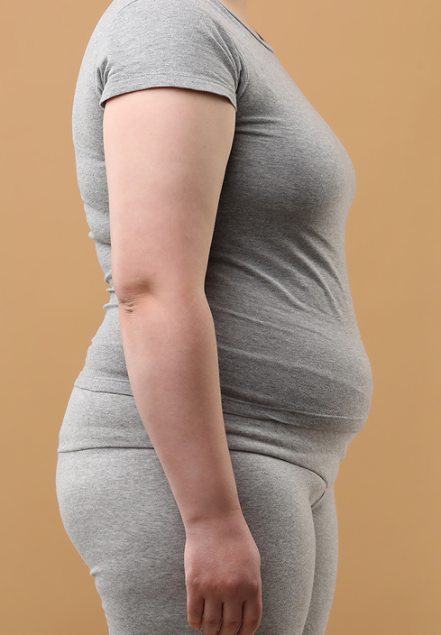 Before profile of Sophia Lanes